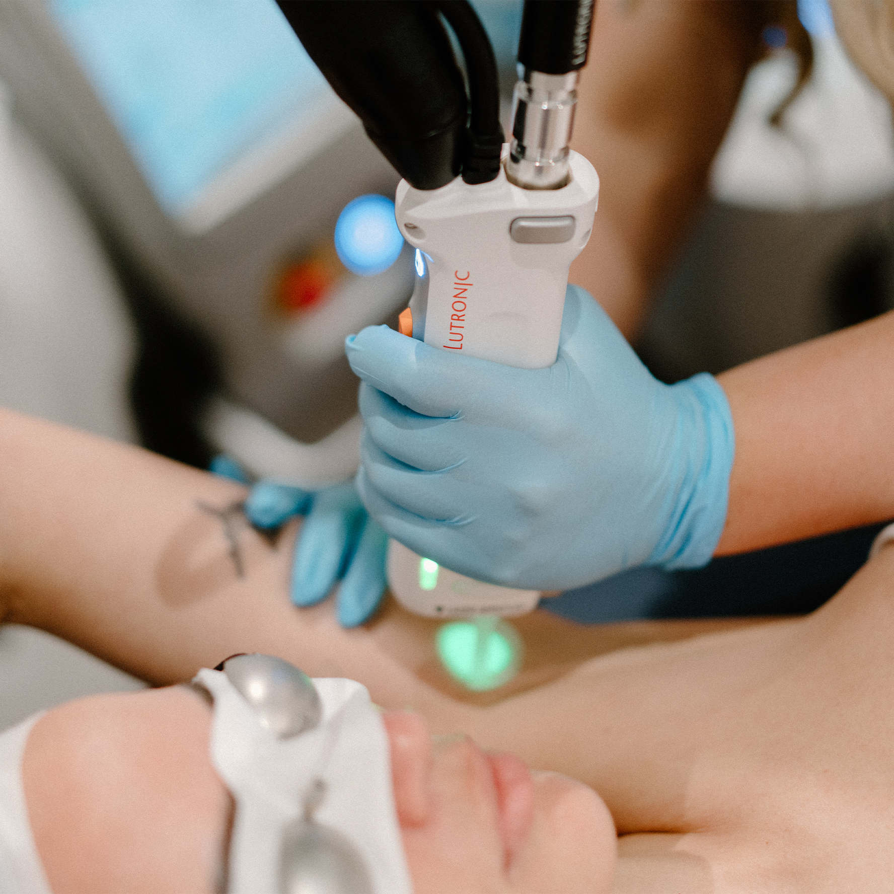 Laser Hair Removal Cambridge